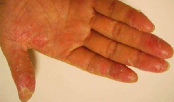 ����Ƥ����ô���� ����Ƥ����Щ���